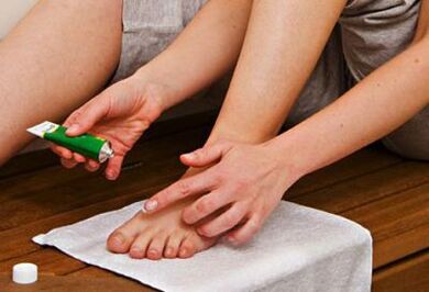 aplicación de pomada para el tratamiento de hongos en las uñas de los pies