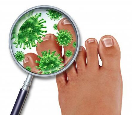 infección por hongos en los pies